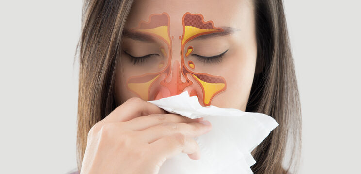 Women with Sinus Infection wiping her Nose