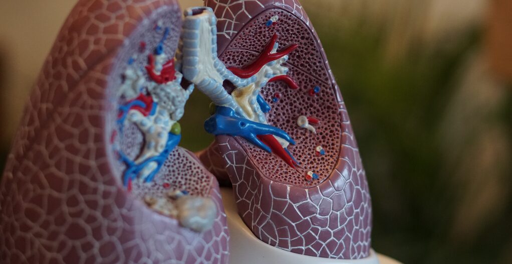 A Model of a Pair of Lungs